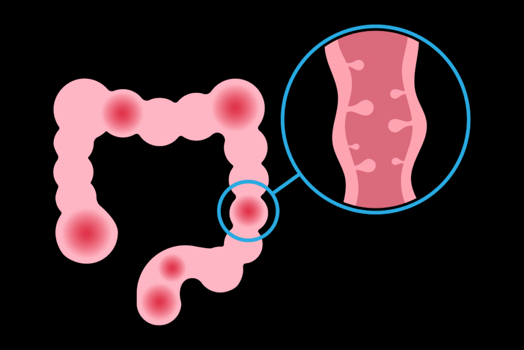 Online SIBO nutritionist consultation through FixMe Nutrition
